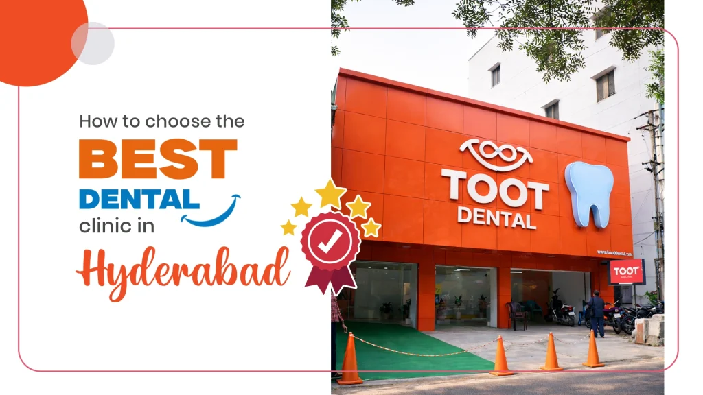 Best Dental Clinic in Hyderabad