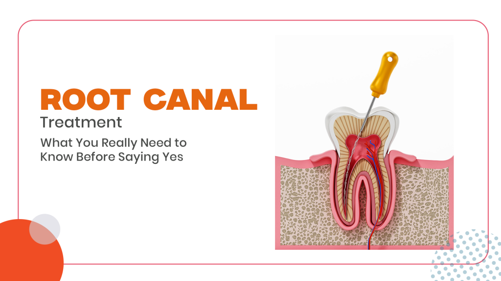 Root Canal Treatment
