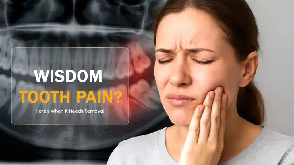 Wisdom Tooth Pain? Here’s When It Needs Removal